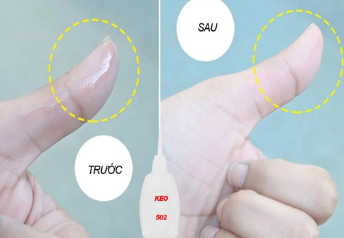 5 Giải Pháp Hiệu Quả Để Gỡ Keo 502