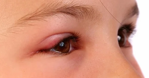 Phân tích mẫu vật