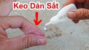 Vấn đề thường gặp khi dính phải keo 502